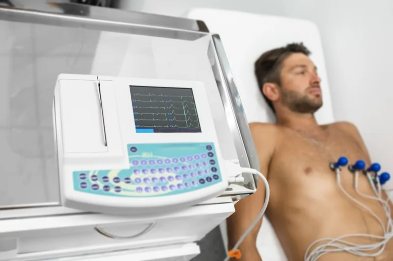 Electrocardiograma